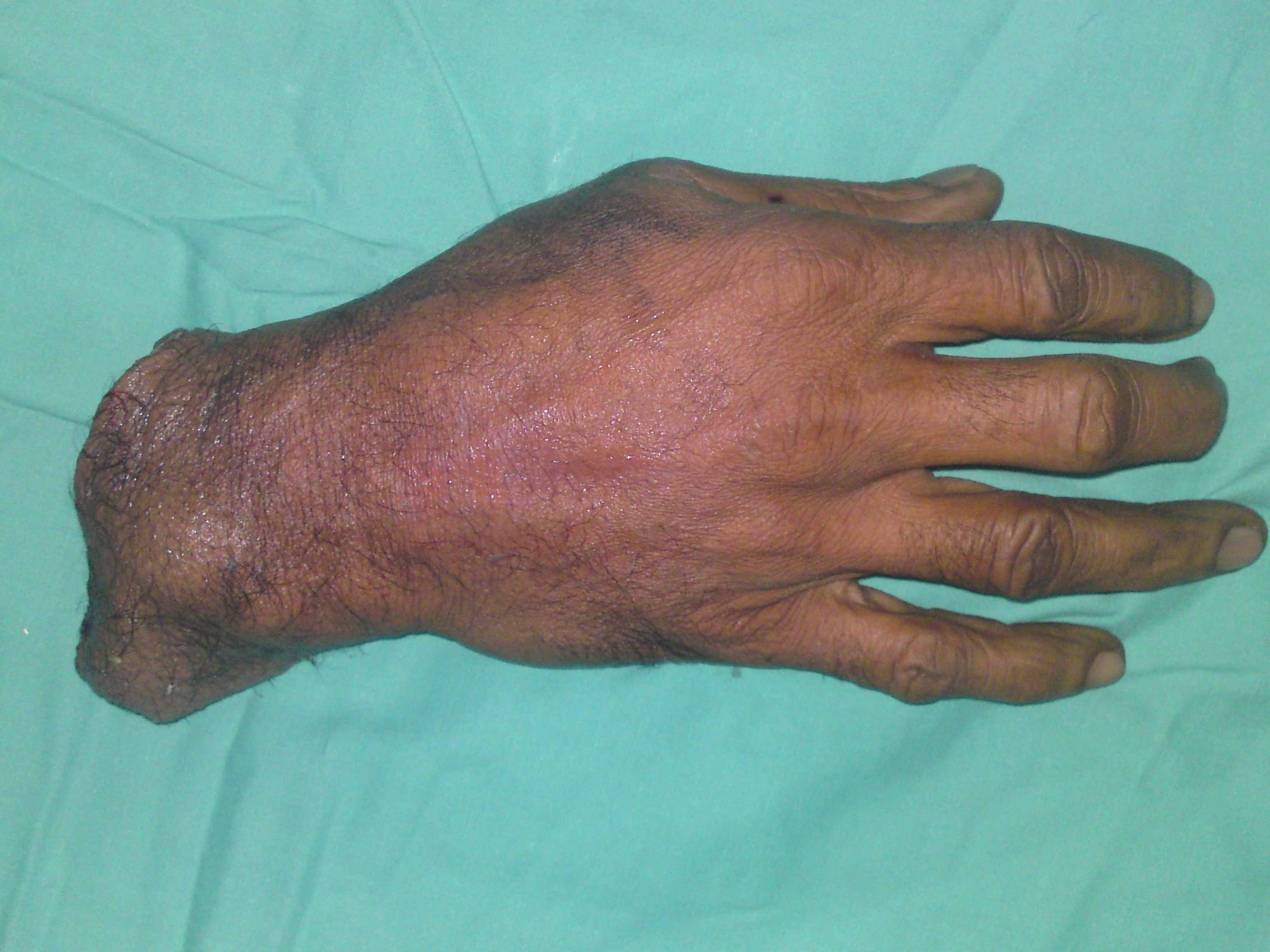 fig 3 f3